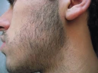 Badem Yağı Sakal Kullanımı ve Faydaları Nelerdir?